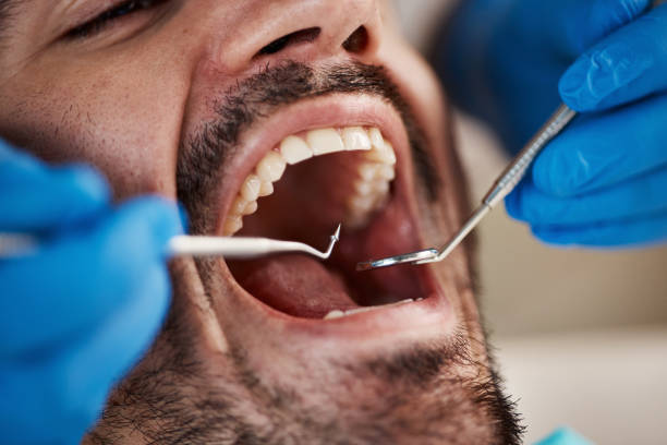 Best Emergency Broken Tooth Repair in Bristol, CT
