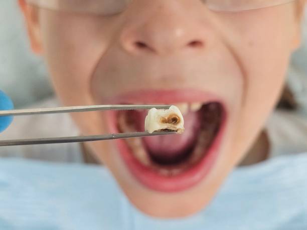 Best Pediatric Emergency Dentist in Bristol, CT